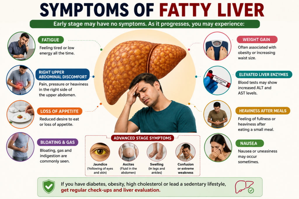 Symptoms of fatty liver including fatigue right upper abdominal pain bloating nausea obesity and elevated liver enzymes